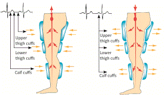 legdiagram.gif